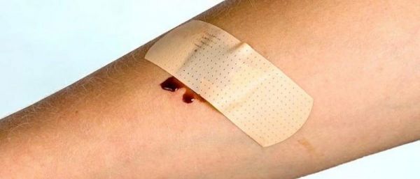 Это должен знать каждый: первые симптомы сепсиса